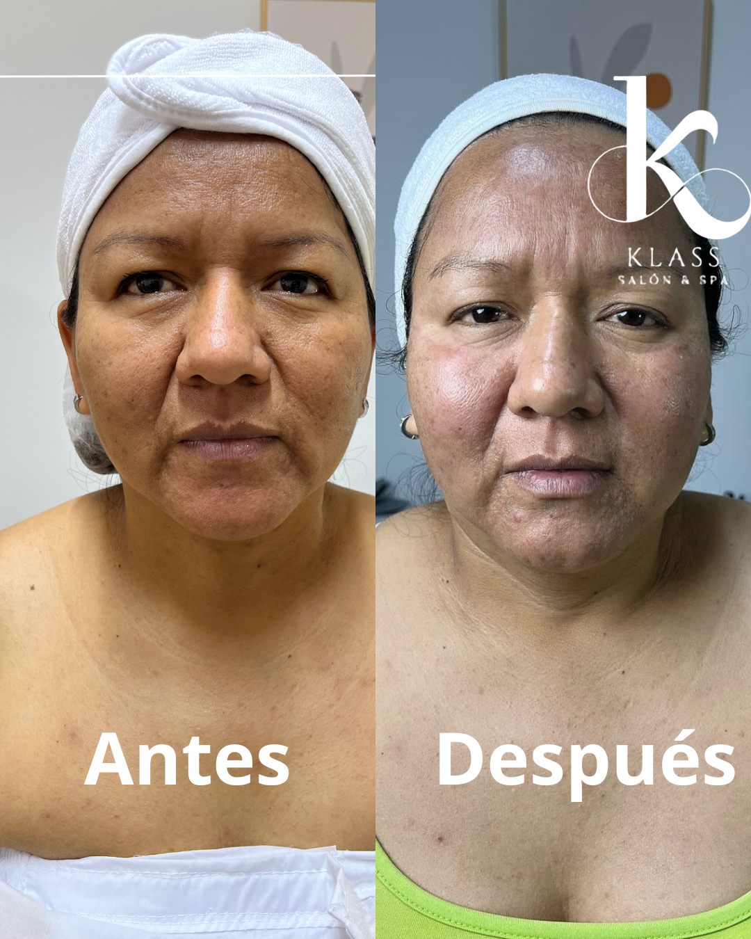 Collage de tratamientos realizados en Klass Salón & Spa
