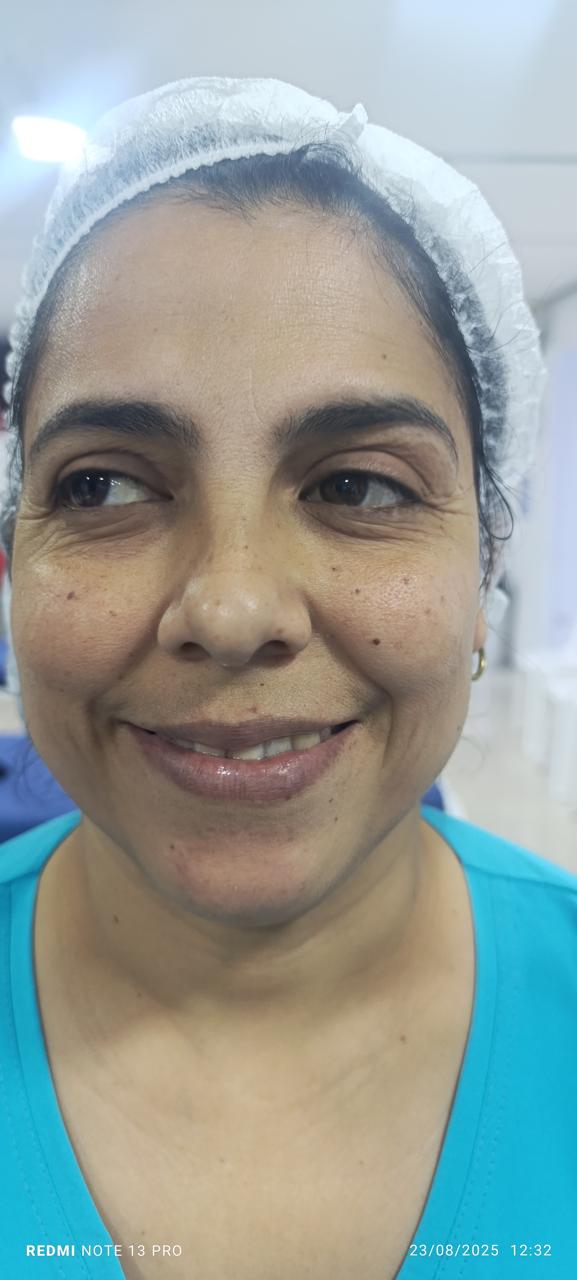 Después del tratamiento — resultado real 7, Klass Salón & Spa