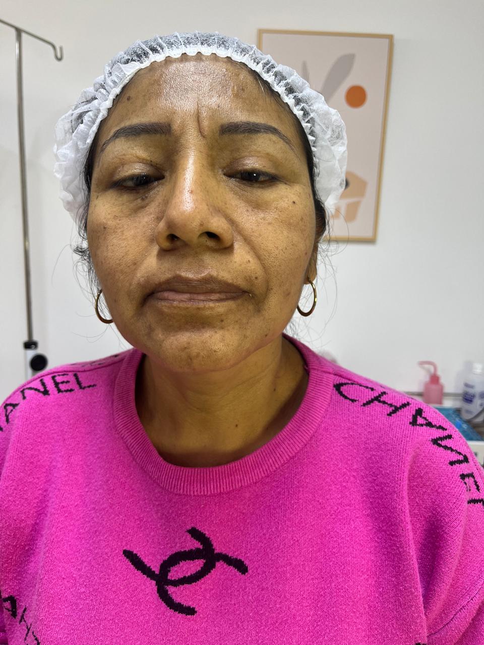 Limpieza Facial Profunda en Klass Salón & Spa